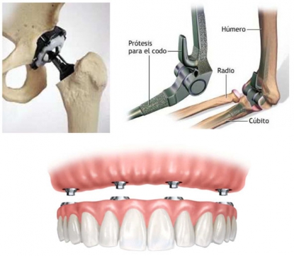 Herramientas de corte para la fabricación de prótesis mecánicas