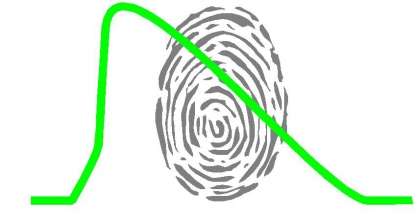 La 'huella dactilar de la piezas' inyectadas