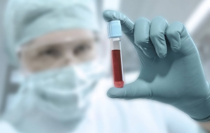 Engel medical, lista para la precisión de alta sensibilidad