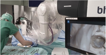 Viendo de manera más clara que nunca