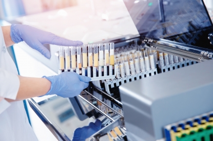 Los sistemas de movimiento lineal de NSK mejoran el rendimiento de equipos de laboratorio y diagnóstico