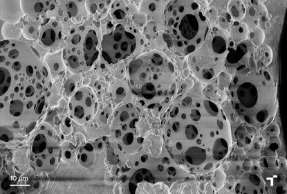 Tekniker desarrolla implantes que logran restaurar el funcionamiento de nervios