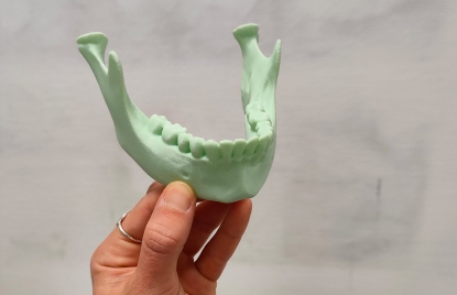 Aimplas trabaja en un servicio integral de impresión 3D flexible para procesos quirúrgicos